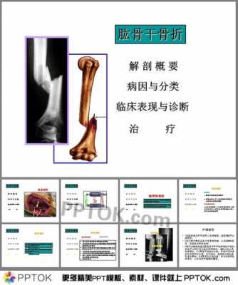 肱骨骨折流程（肱骨骨折的恢复过程）-第2张图片-祥安律法网