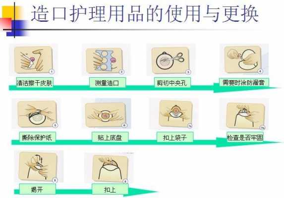 造口袋医保报销流程（造口袋在医院买报销吗）-第3张图片-祥安律法网