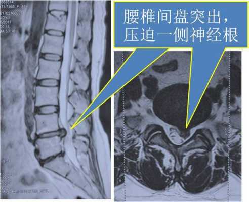 检查腰部的流程（检查腰部怎么检查什么）-第3张图片-祥安律法网