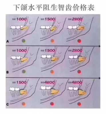 宁波拔智齿报销流程（宁波拔智齿能报医保吗）-第1张图片-祥安律法网