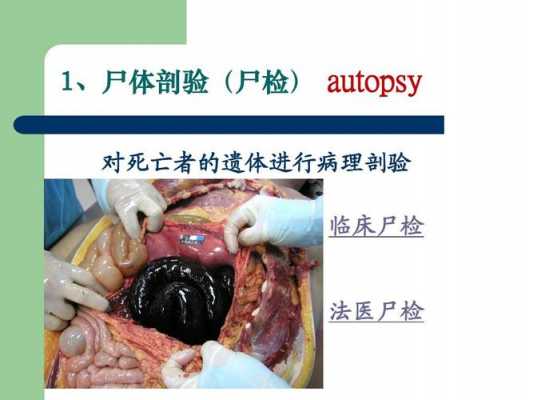 验尸的流程（验尸的叫什么）-第2张图片-祥安律法网